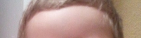 stirnfrei